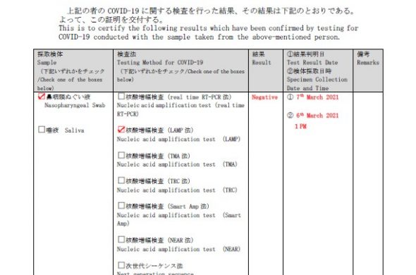 入国制限緩和はいつ？日本